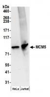 Detection of human MCM5 by western blot.