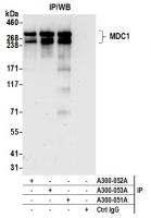Detection of human MDC1 by western blot
