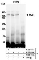 Detection of human MLL1 by western blot