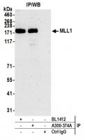Detection of human MLL1 by western blot