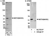 Detection of human MST4(MASK) by western