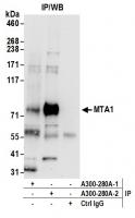 Detection of human MTA1 by western blot