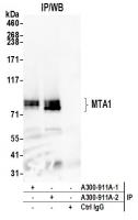 Detection of human MTA1 by western blot
