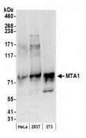 Detection of human and mouse MTA1 by wes