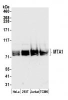 Detection of human and mouse MTA1 by wes