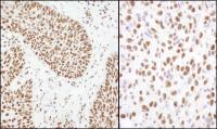 Detection of human and mouse Matrin 3 by