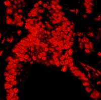 Detection of human expndtw-6 Matrin 3 by