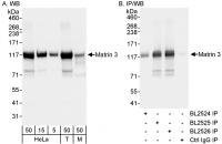 Detection of human and mouse Matrin 3 by