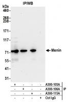 Detection of human Menin by western blot