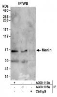 Detection of human Menin by western blot