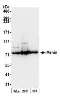 Detection of human and mouse Menin by we