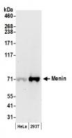 Detection of human Menin by western blot