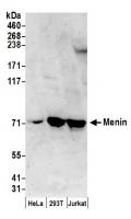 Detection of human Menin by western blot