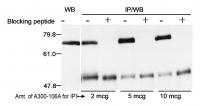Detection of human Menin by western blot