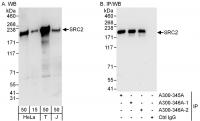 Detection of human NCOA2/SRC2 by western