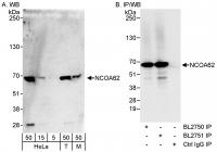 Detection of human and mouse NCOA62 by w