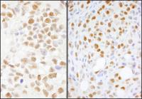 Detection of human and mouse NONO by imm