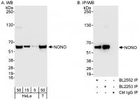 Detection of human NONO by western blot