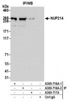 Detection of human NUP214 by western blo