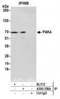 Detection of human PAK4 by western blot