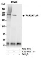 Detection of human PARC/H7-AP1 by wester