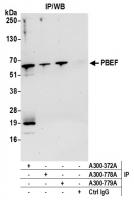 Detection of human PBEF by western blot