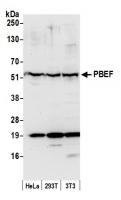 Detection of human and mouse PBEF by wes