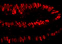 Detection of human PCNA by immunohistoch