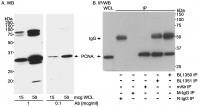 Detection of human PCNA by western blot