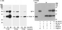 Detection of human PCNA by western blot