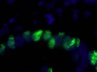 Detection of human PCNA by immunohistoch