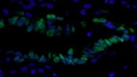 Detection of human PCNA by immunohistoch