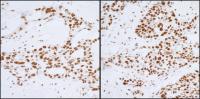 Detection of human PELP1/MNAR by immunoh