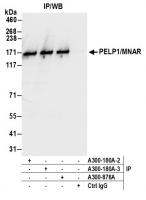 Detection of human PELP1/MNAR by western