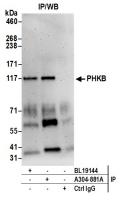 Detection of human PHKB by western blot