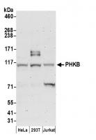 click to view larger size Detection of human PHKB by western blot.
