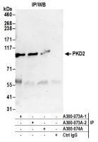Detection of human PKD2 by western blot