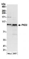Detection of human PKD2 by western blot.
