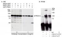 Detection of human PKD2 by western blot