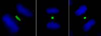 Detection of human PLK1 by immunocytoche