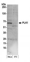 Detection of human PLK1 by western blot.