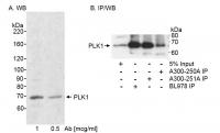 Detection of human PLK1 by western blot