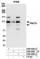 Detection of human PNUTS by western blot