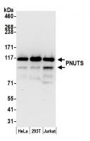 Detection of human PNUTS by western blot
