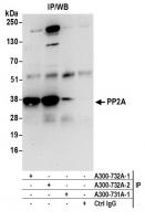 Detection of human PP2A by western blot