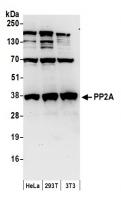 Detection of human and mouse PP2A by wes