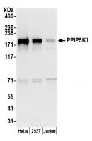 Detection of human PPIP5K1 by western bl