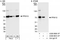 Detection of human PPM1G by western blot