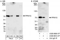 Detection of human and mouse PPM1G by WB