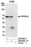 Detection of human PPP2R1A by western bl